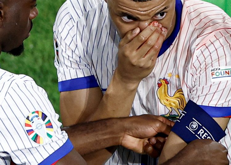 Por qué el Real Madrid queda "impotente" tras la lesión en la nariz de la ex estrella del PSG